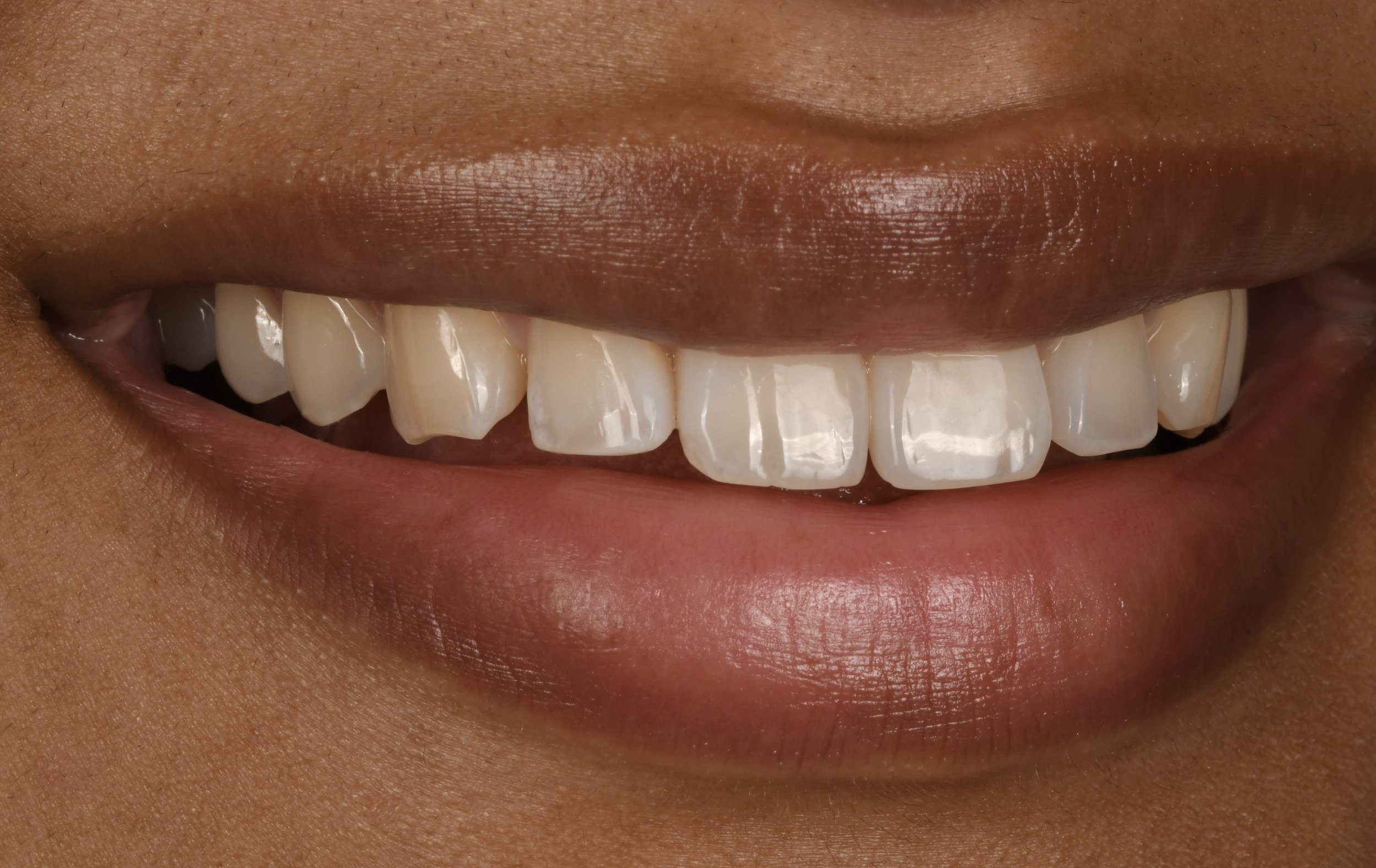 smileページ r.smile25 KAWASAKI NINJA ZX-25R SE 2023 OEM PART 39156-2652 | eBay